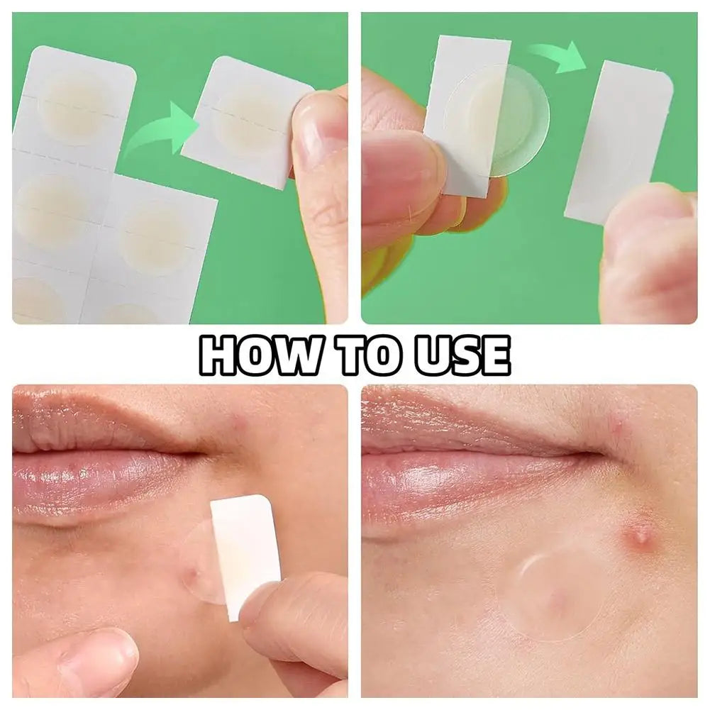 Microneedle Acne Patch Acne Removal Waterproof Smooth Concealer Invisible Breathable Patch Acne Cover Patches Gentle Makeup Tool